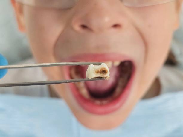 Best Chipped Tooth Repair Near Me  in Boyceville, WI